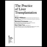 Practice of Liver Transplantation
