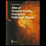 Atlas of Posterior Fundus Changes