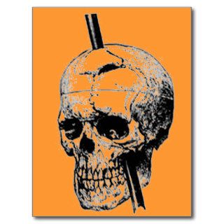 Driving A Long Nail Through The Skull Of A Corpse Post Cards
