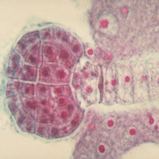 Shepherd's Purse (Capsella) Young Embryo, l.s., 12 µm Microscope Slide