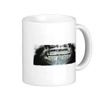 X Ray Coffee Mugs