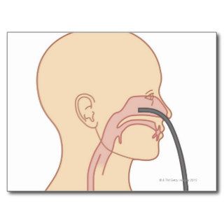 Anterior Rhinoscopy Post Card