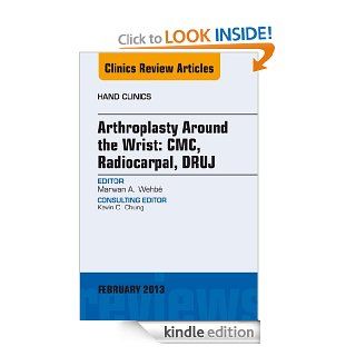 Arthroplasty Around the Wrist CME, RADIOCARPAL, DRUJ, An Issue of Hand Clinics, (The Clinics Orthopedics) eBook Marwan A. Wehbe Kindle Store