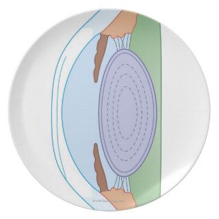 Eye After Corrective Surgery Party Plate