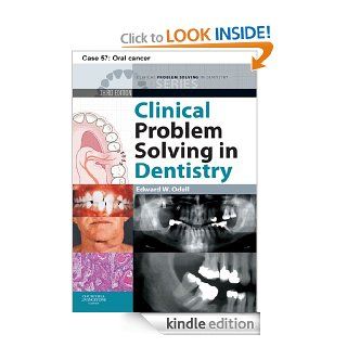 Oral cancer eBook Odell Kindle Store