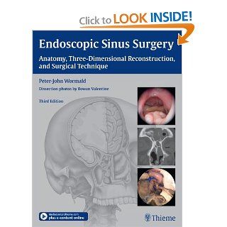 Endoscopic Sinus Surgery Anatomy, Three Dimensional Reconstruction, and Surgical Technique (9781604066876) Peter John Wormald Books