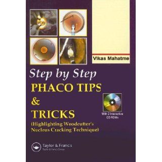 Step by Step Phacoemulsification Tips and Tricks Vikas Mahatme 0001841845485 Books