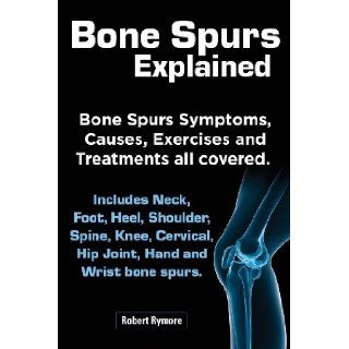 Bone Spurs Explained. Bone Spurs Symptoms, Causes, Exercises and Treatments All Covered. Includes Neck, Foot, Heel, Shoulder, Spine, Knee, Cervical, H Robert Rymore 9781909151499 Books
