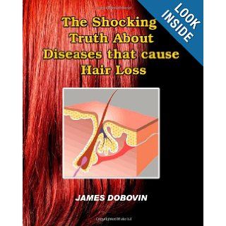 The Shocking Truth About Diseases that Cause Hair Loss Secrets You Need to Know About Losing Hair So You Can Stop From Going Bald James Dobovin 9781451518788 Books