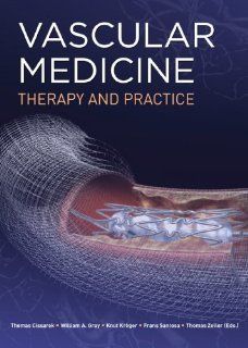 Vascular Medicine Therapy and Practice Thomas Cissarek, Knut Kroger, Frans Santosa, Thomas Zeller, William Gray 9780071750929 Books