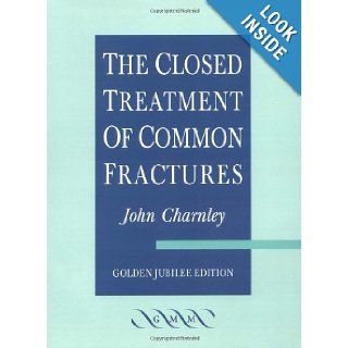 The Closed Treatment of Common Fractures John Charnley 9781841101682 Books