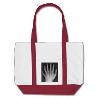 Polydactyly, Six Fingered Hand, X Ray, rarity Tote Bag