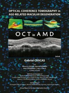 Optical Coherence Tomography in Age Related Macular Degeneration (OCT in AMD) 9783642101816 Medicine & Health Science Books @